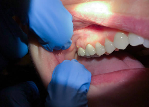 Best Same-Day Emergency Dentist in Pleasant Hills, MD