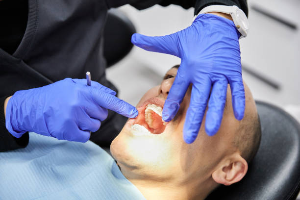 Best Emergency Wisdom Teeth Removal in Pleasant Hills, MD